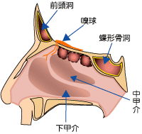 副鼻腔炎（蓄膿症）の原因