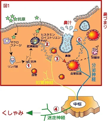 アレルギー性鼻炎はどうして起こるの？