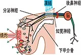 ラジオ波下甲介焼灼術（レーザー手術）＋後鼻神経凍結術