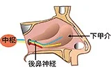 （鼻中隔矯正術）＋粘膜下下甲介骨切除術＋後鼻神経切断術