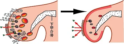 術後の経過