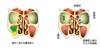 鼻汁・後鼻漏