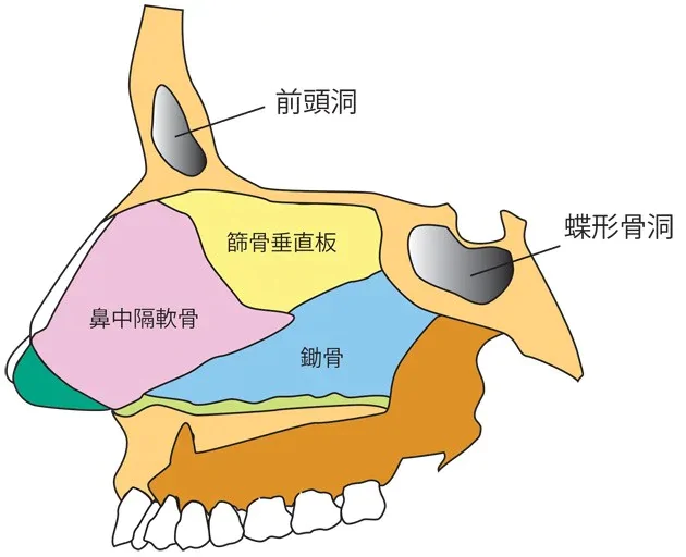 副鼻腔炎図2