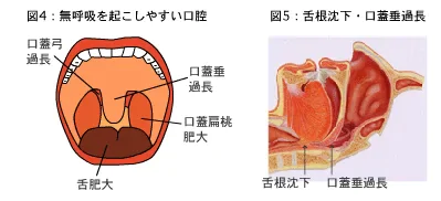 軟口蓋・口蓋垂・舌根部